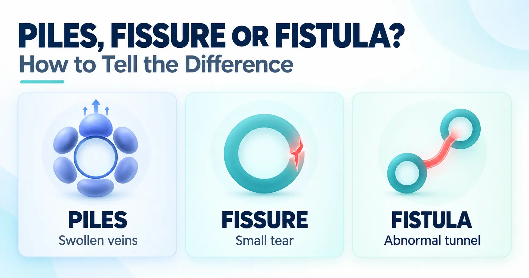 Difference between piles fissure and fistula explained by a proctologist in Bangalore